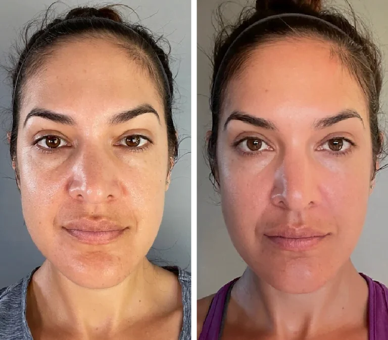 Gua Sha Facial Set (2 Pieces)