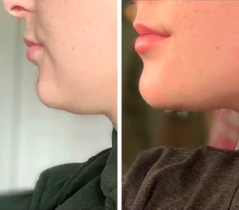 Gua Sha Facial Set (2 Pieces)