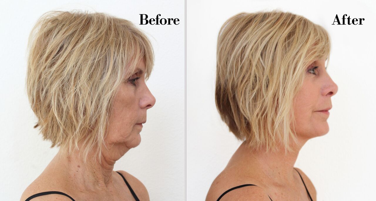 One® Natural Instant Lift Neck Tape (20 Strips)
