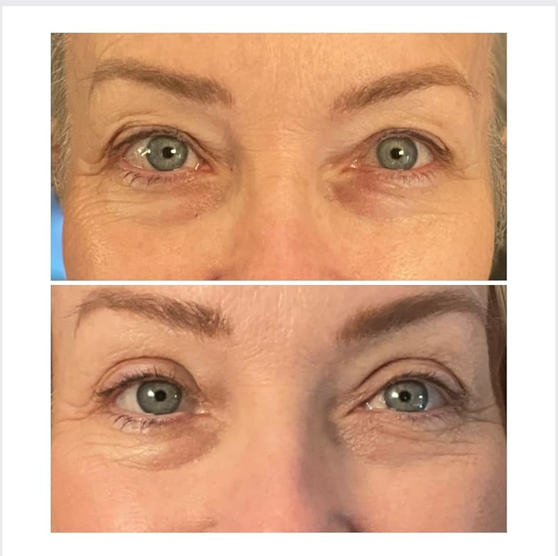 One® Natural Invisible Eyelid (90 Strips)