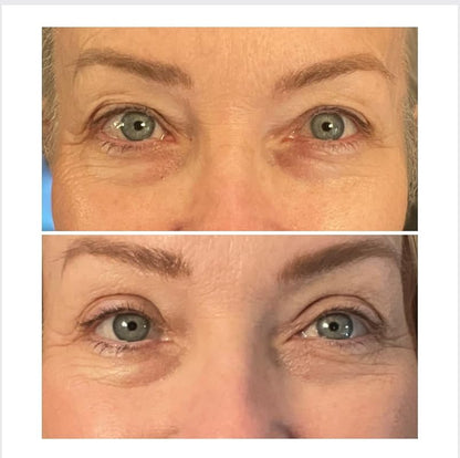 One® Natural Invisible Eyelid (90 Strips)