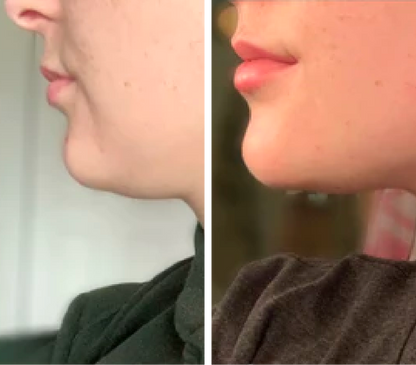 Gua Sha Facial Set (2 Pieces)