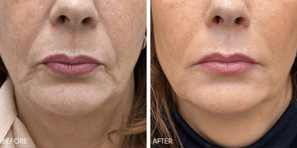 One® Natural Silk Collagen Ampoule