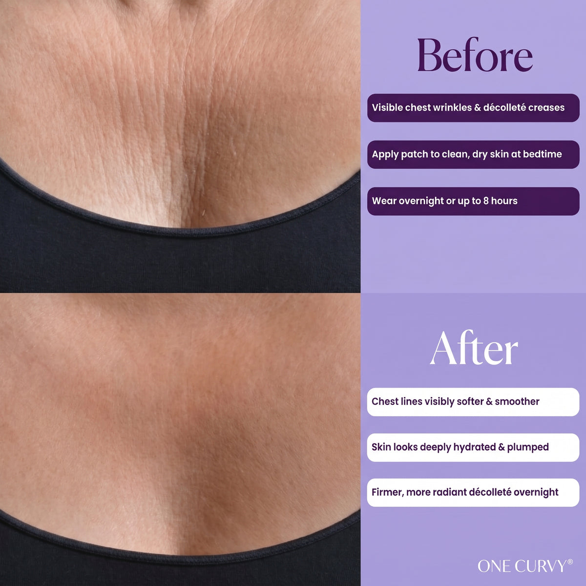 One® Chest Wrinkle Patches (Reusable)
