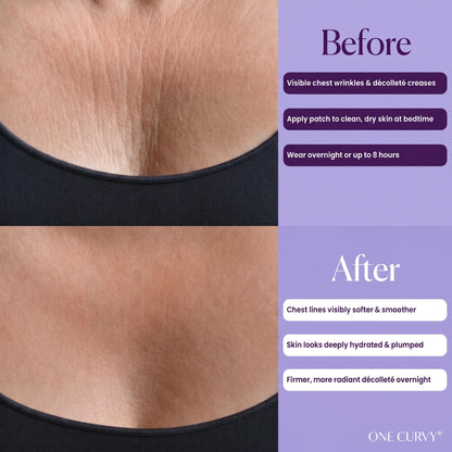 One® Chest Wrinkle Patches (Reusable)