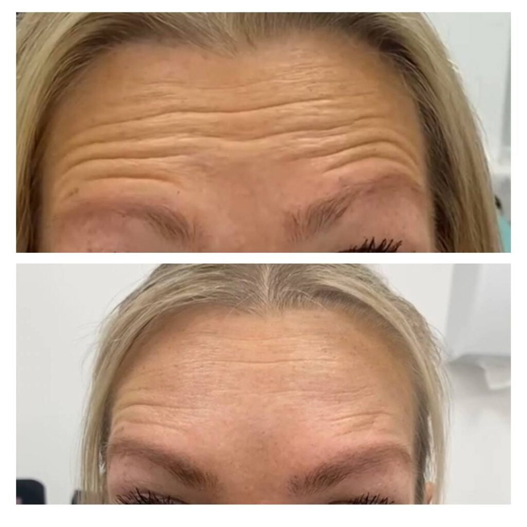 One® Natural Silk Collagen Ampoule
