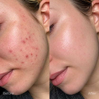 Dr. Althea 345 Relief Cream 50ml
