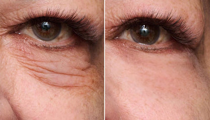 One® Instant Eye Tightener