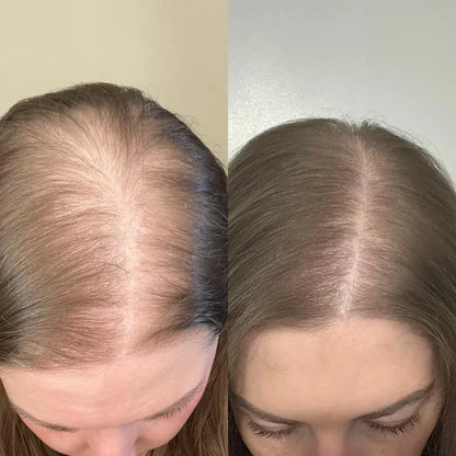 One® Hair-Concealer