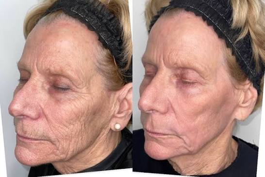 One® Natural Silk Collagen Ampoule